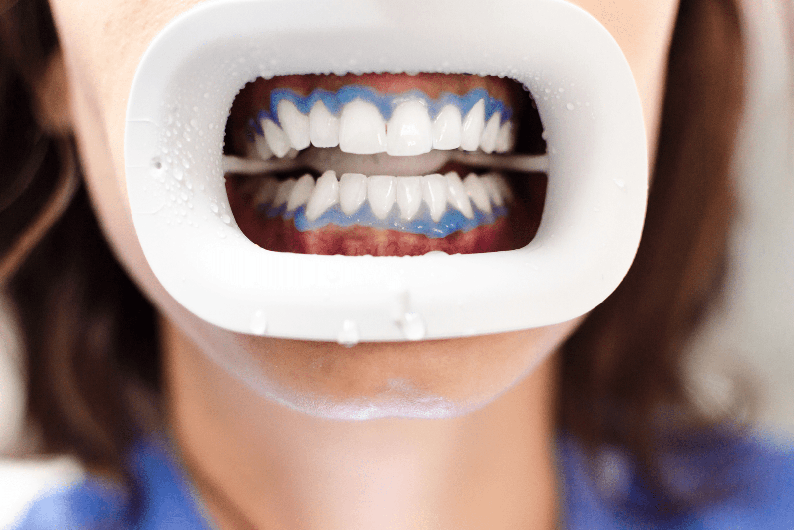 dental exam & Teeth Cleaning gorgeous smiles dental northampton, ma