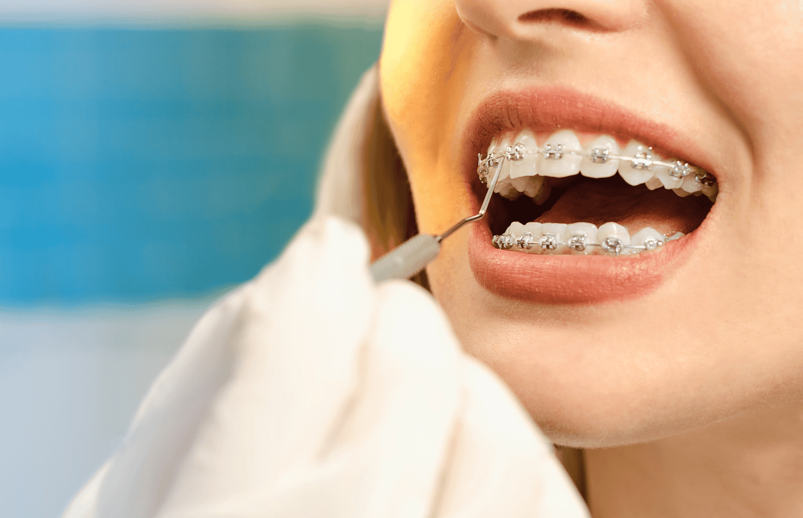 braces in ma and ct