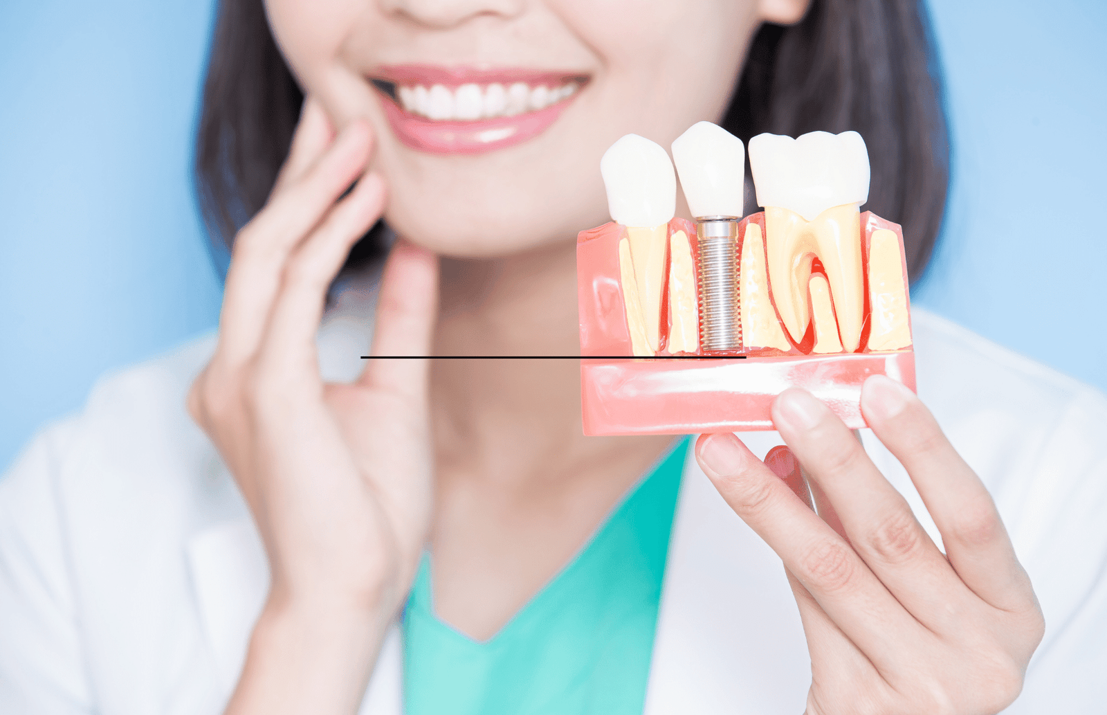 dental implant in farmington , ct