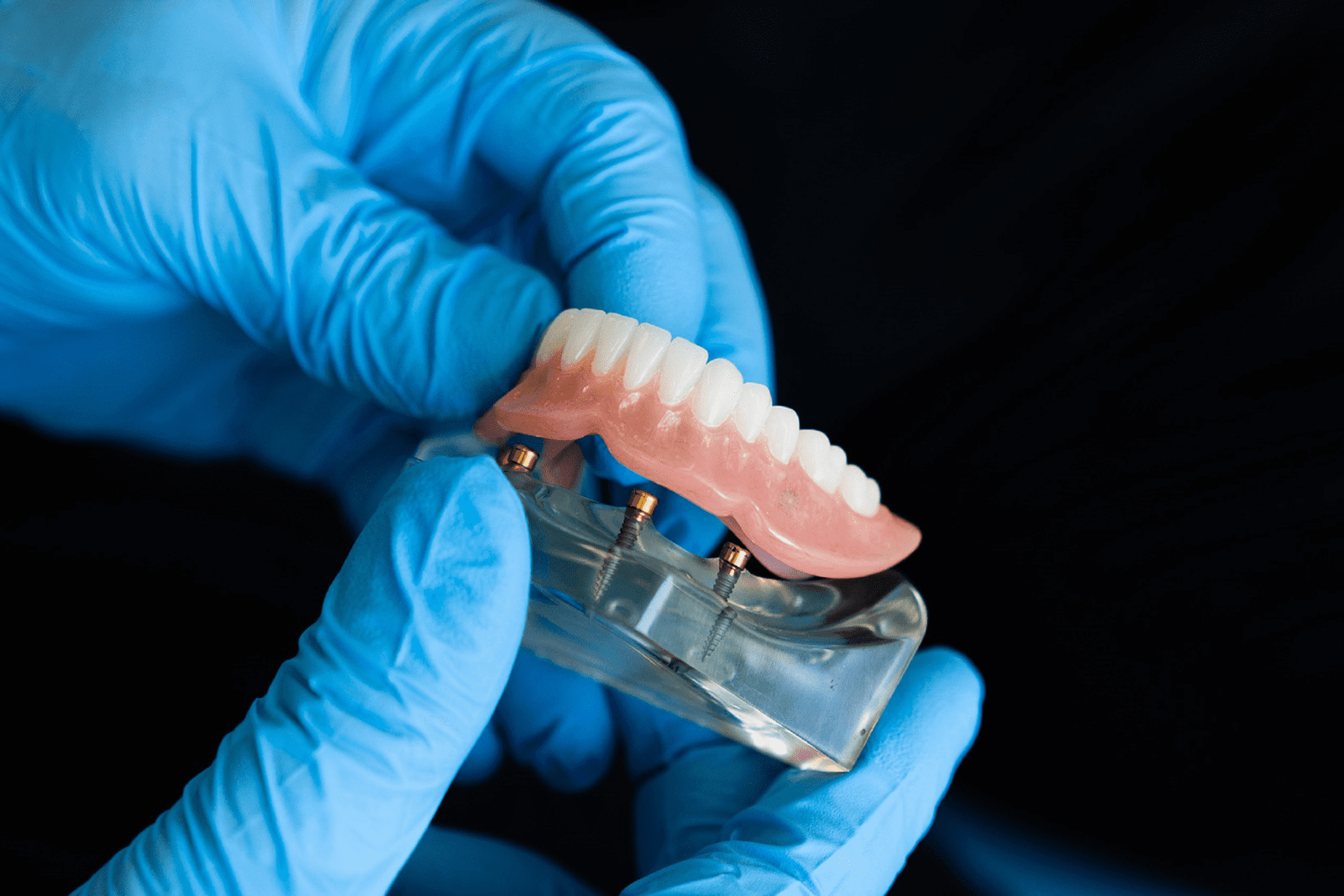 full dentures & partial dentures in northampton ma