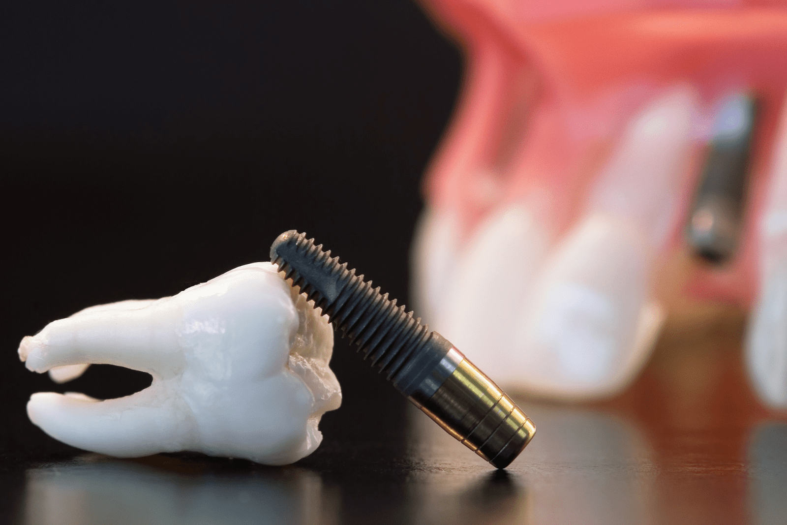 implant supported dentures in chicopee