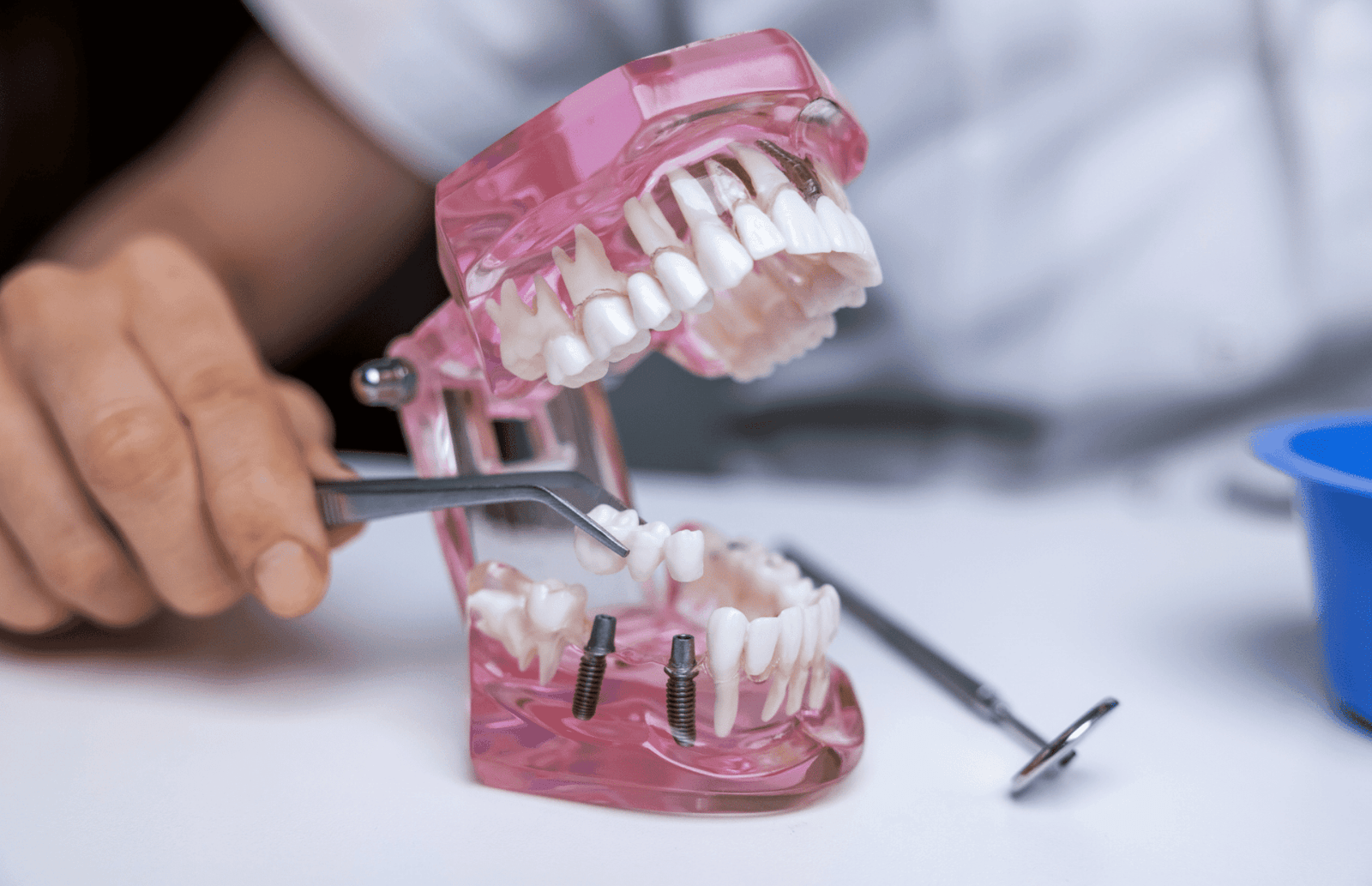 implant supported dentures in springfeild ma