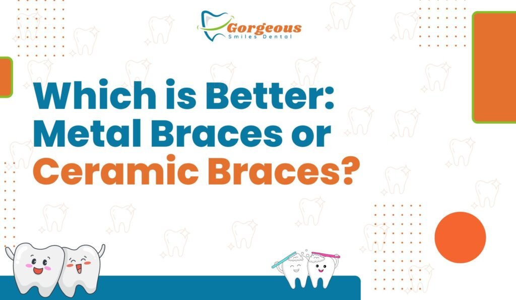 Comparison image showing two types of braces: on the left, metal braces with shiny silver brackets and wires, and on the right, ceramic braces featuring clear brackets that blend with the teeth. The background includes a split design highlighting key differences, such as visibility, comfort, and cost.