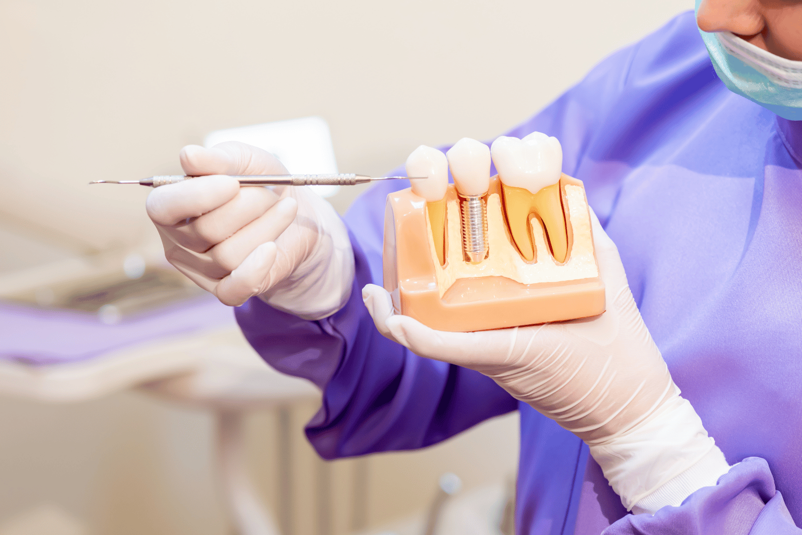 Implant-Supported Dentures in Farmington