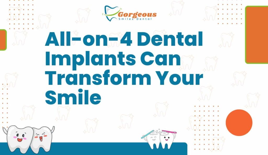 All-on-4 Dental Implants Can Transform Your Smile