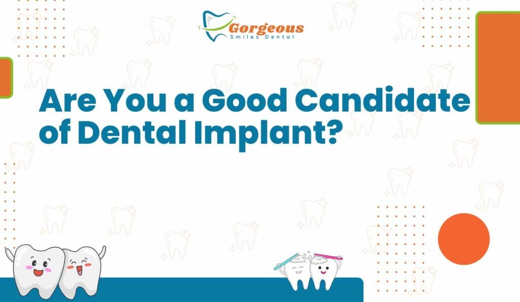 Are You a Good Candidate for Dental Implants?