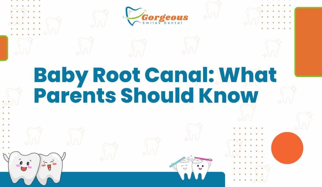 Baby Root Canal: What Parents Should Know