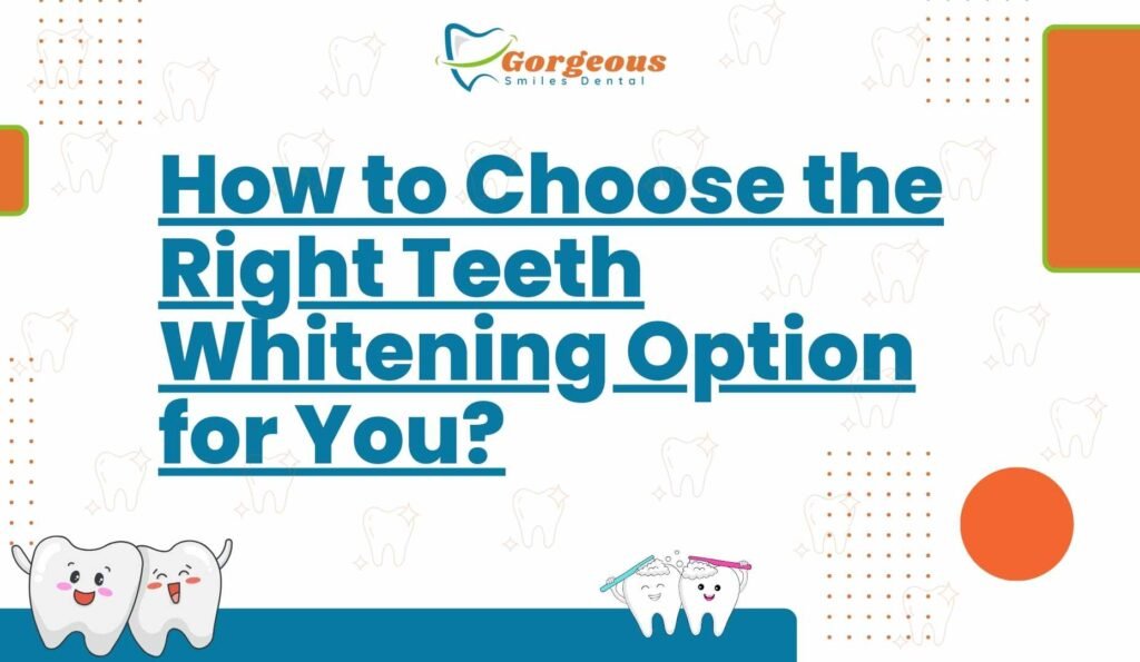 How to Choose the Right Teeth Whitening Option for You?