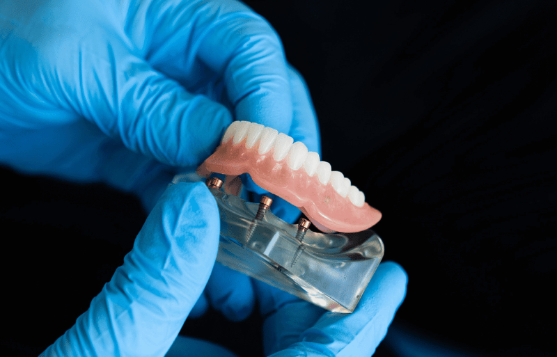 full dentures & partial dentures in northampton ma