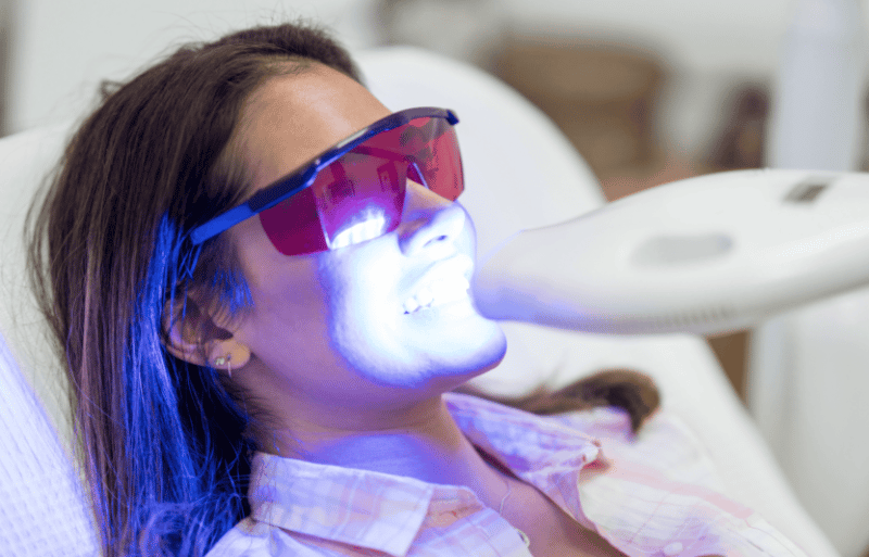 teeth whitening in farmington