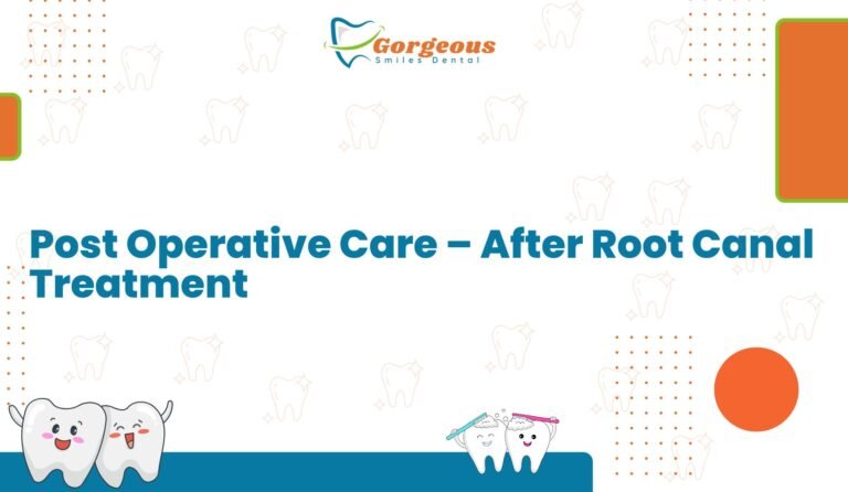 Post Operative Care – After Root Canal Treatment | Gorgeous Smiles Dental