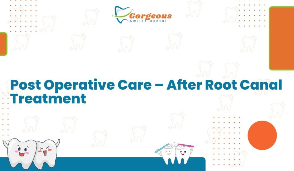 Post Operative Care – After Root Canal Treatment