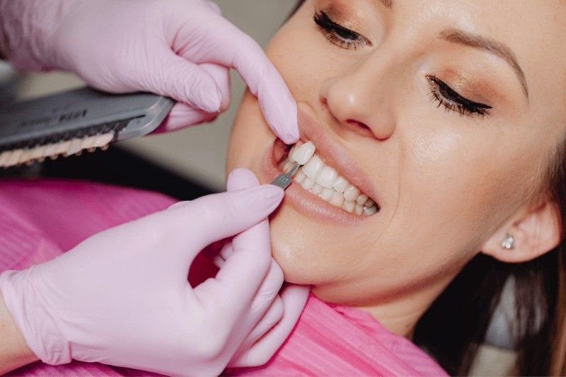 Porcelain Veneers in Hartford