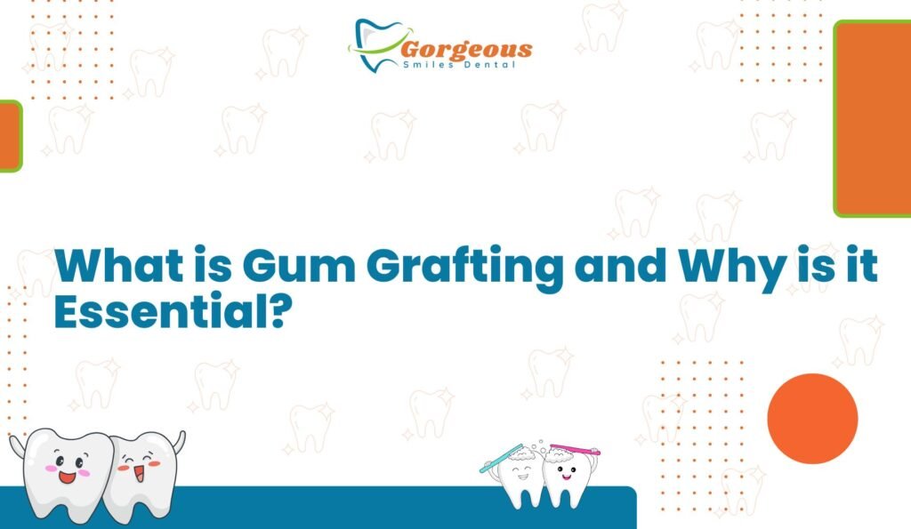 What is Gum Grafting and Why is it Essential?