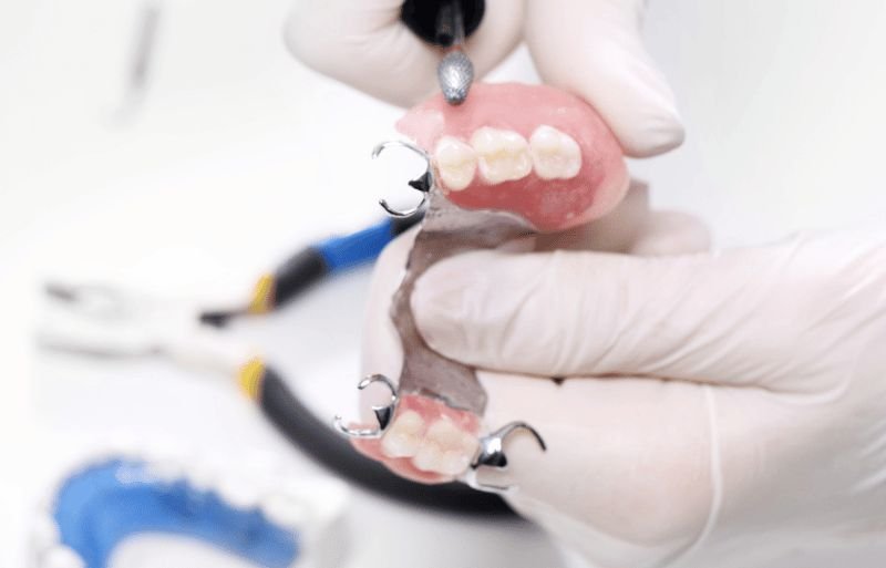 Fillings, Crowns & Bridge in Southington, CT