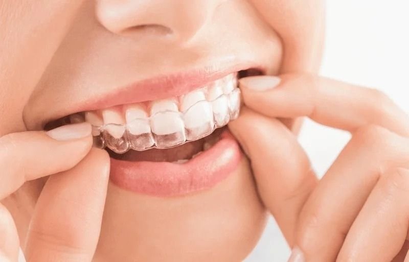 Invisalign in farmington ct